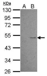 Anti-p53 antibody [C2C3], C-term used in Western Blot (WB). GTX118730